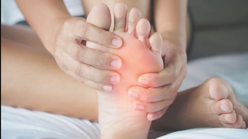 تورم القدمين 