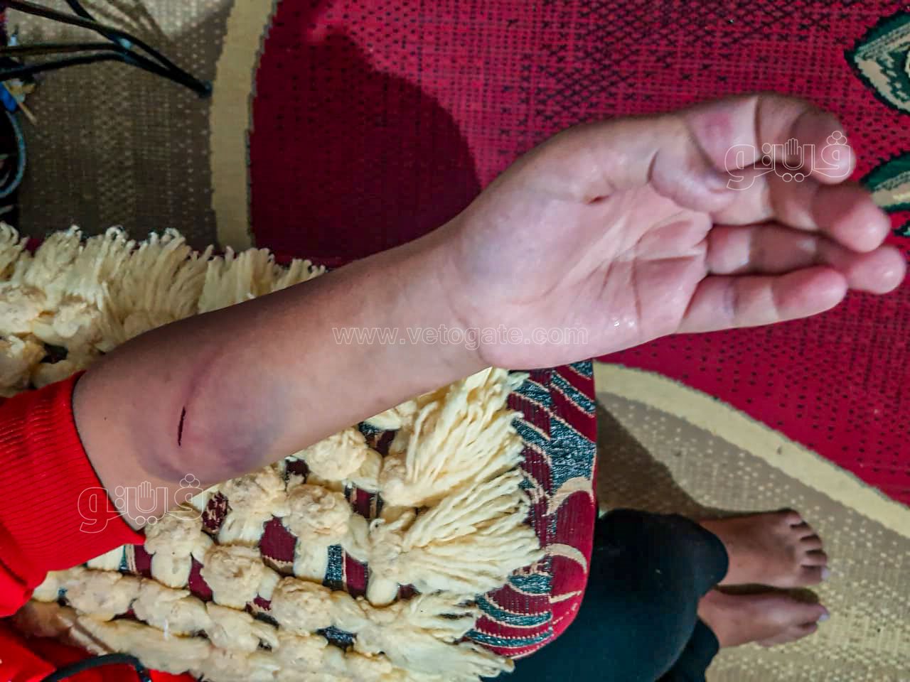 طالب اعتدى مدرس عليه بالضرب واحدث إصابته