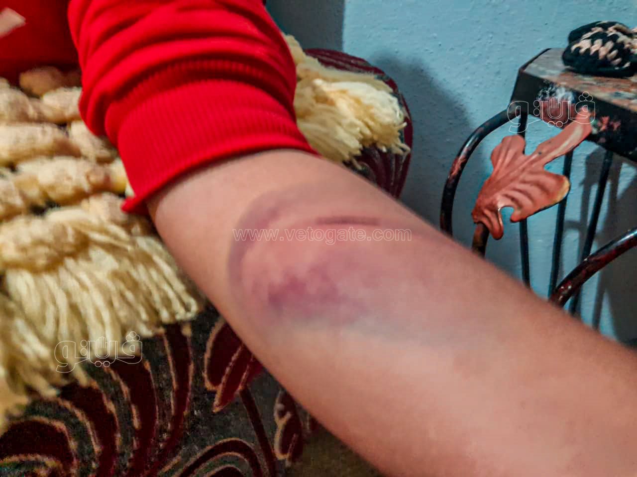 طالب اعتدى مدرس عليه بالضرب واحدث إصابته-2