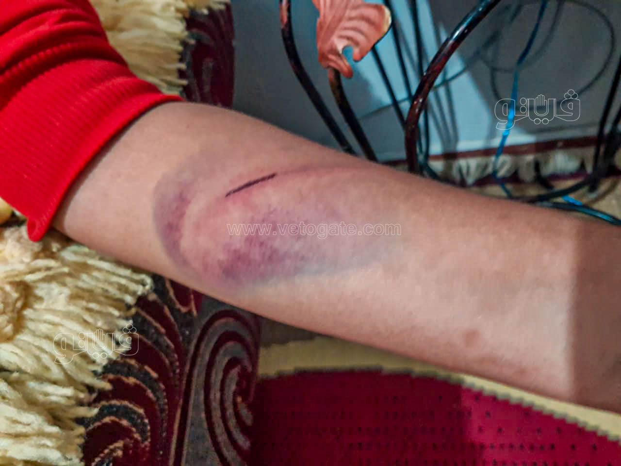 طالب اعتدى مدرس عليه بالضرب واحدث إصابته-3