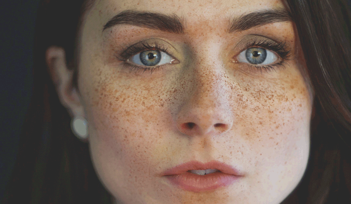 قناع يخلصك من النمش