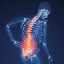 هشاشة العظام