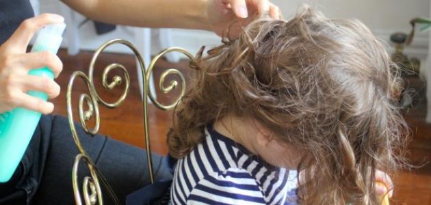 تشابكات الشعر