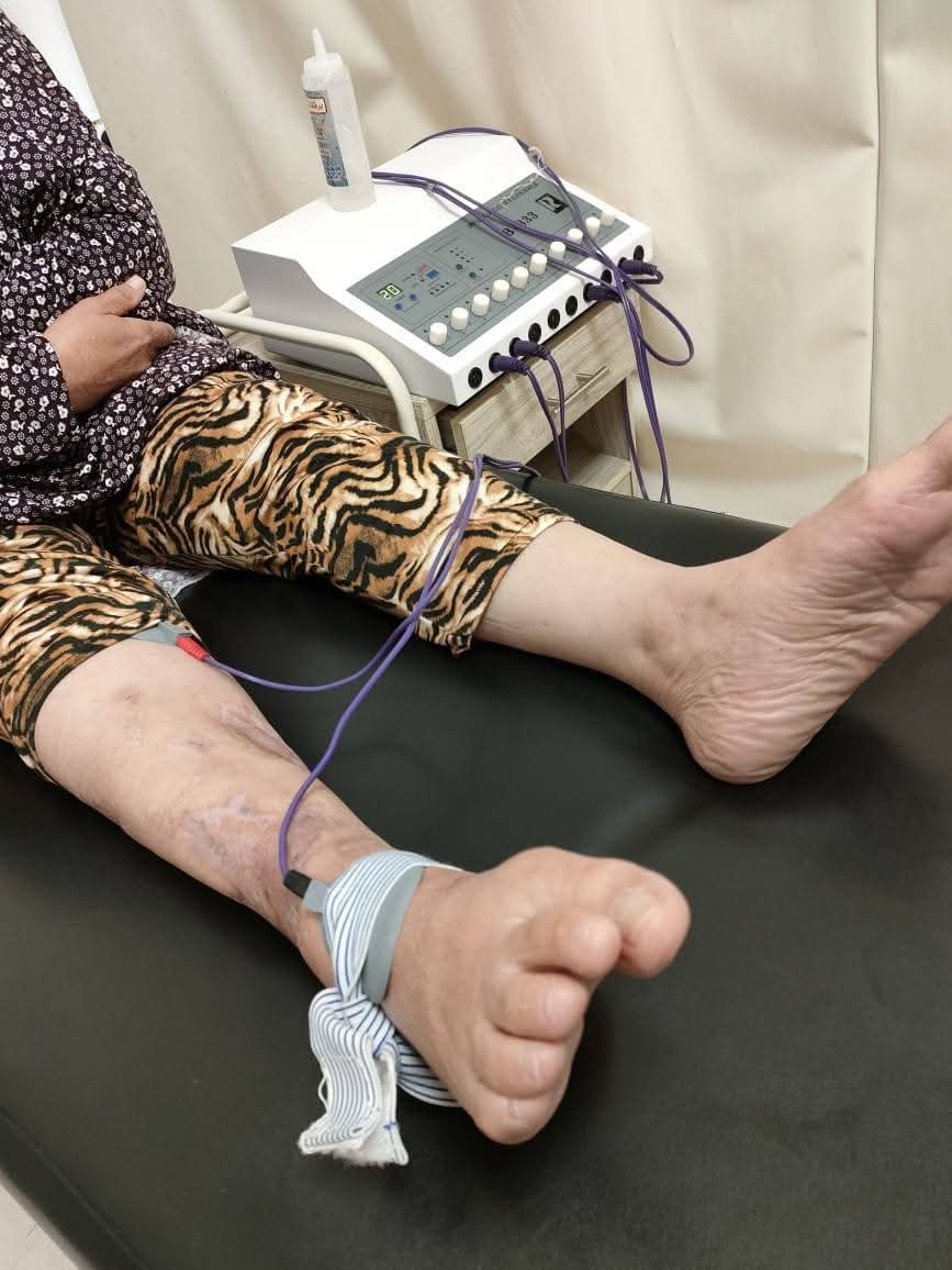 جانب من العمل بمراكز العلاج الطبيعي،فيتو