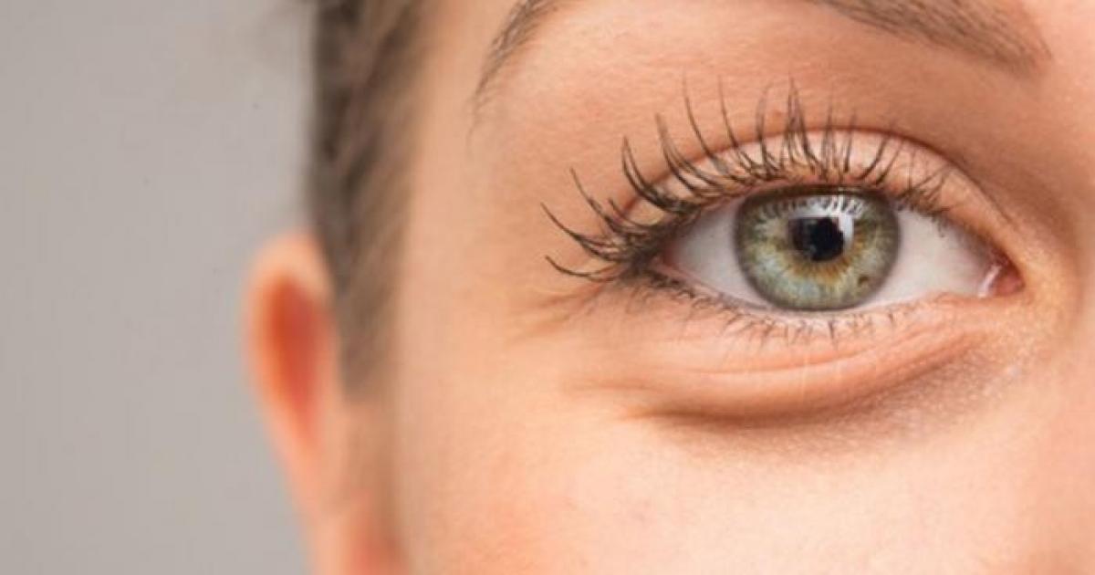 انتفاخات تحت العين