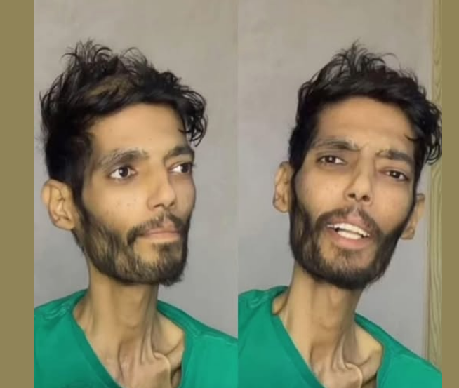 <strong>تطورات الحالة الصحية لإبراهيم شيكا، فيتو</strong>