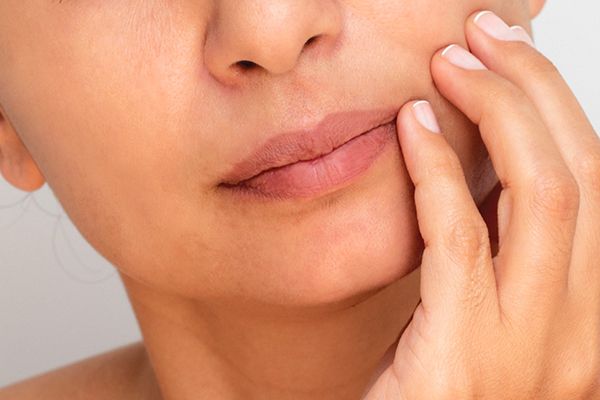 جفاف الشفاه 