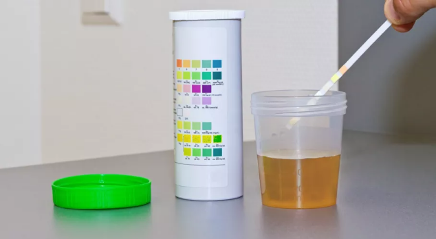 شرائط تحليل السكر وكيمياء البول، فيتو