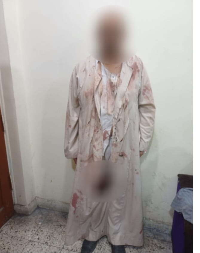 عليه ديونه ويتهرب من سدادها.. الأمن يكشف حقيقة فيديو سمسار أدعي تعرضه للضرب على يد صاحب مقهى بقنا