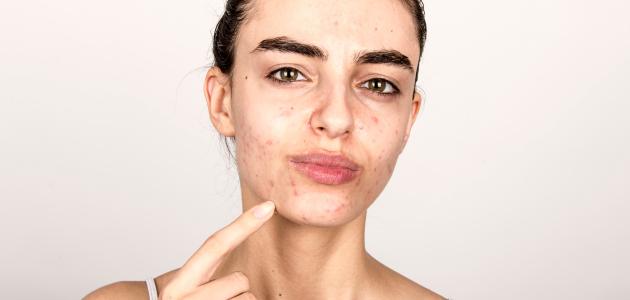 تونر الشاى الأخضر