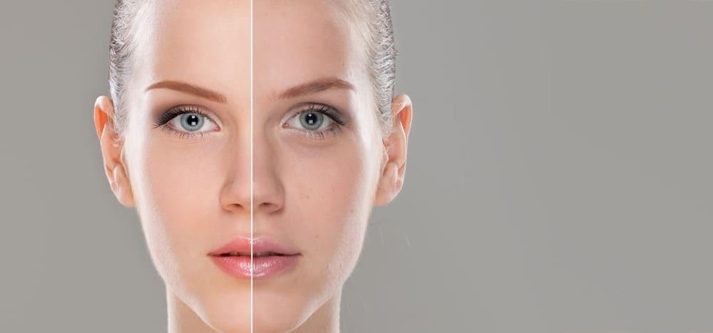 قناع الزبادي لترطيب وتفتيح البشرة 