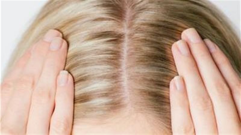 تنظيف فروة الرأس