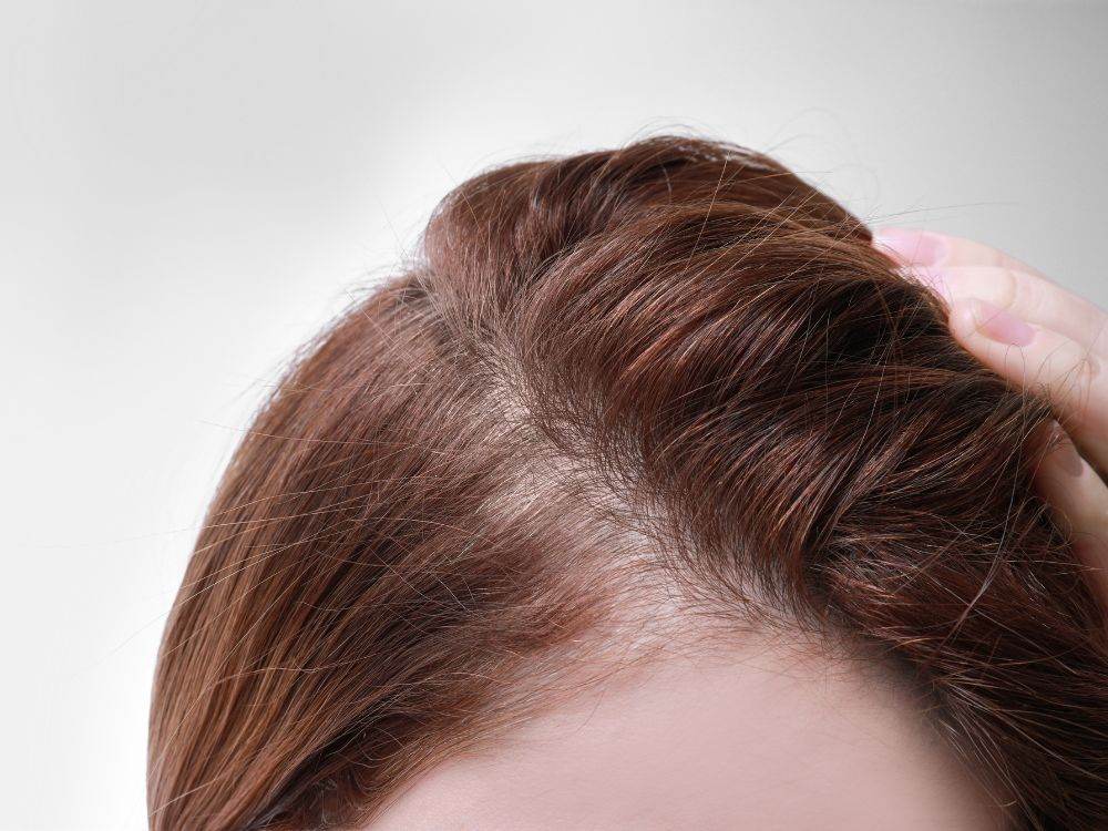 علاج الشعر الخفيف 