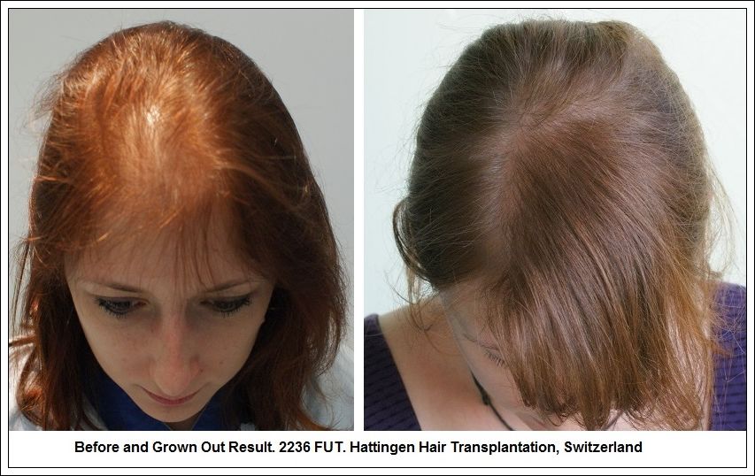 وصفات لشعرك الخفيف