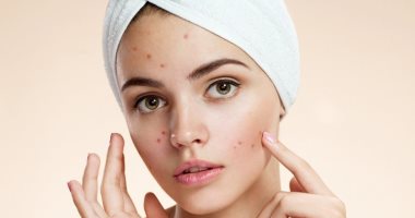 قناع طبيعي لتقشير البشرة الدهنية 