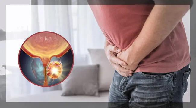 سرطان البروستاتا