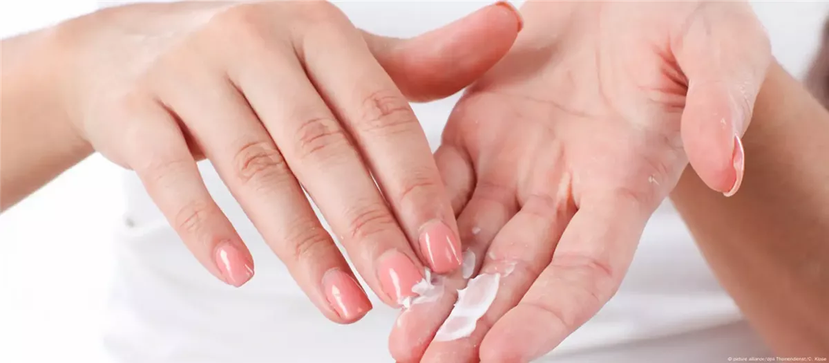 تشققات اليدين