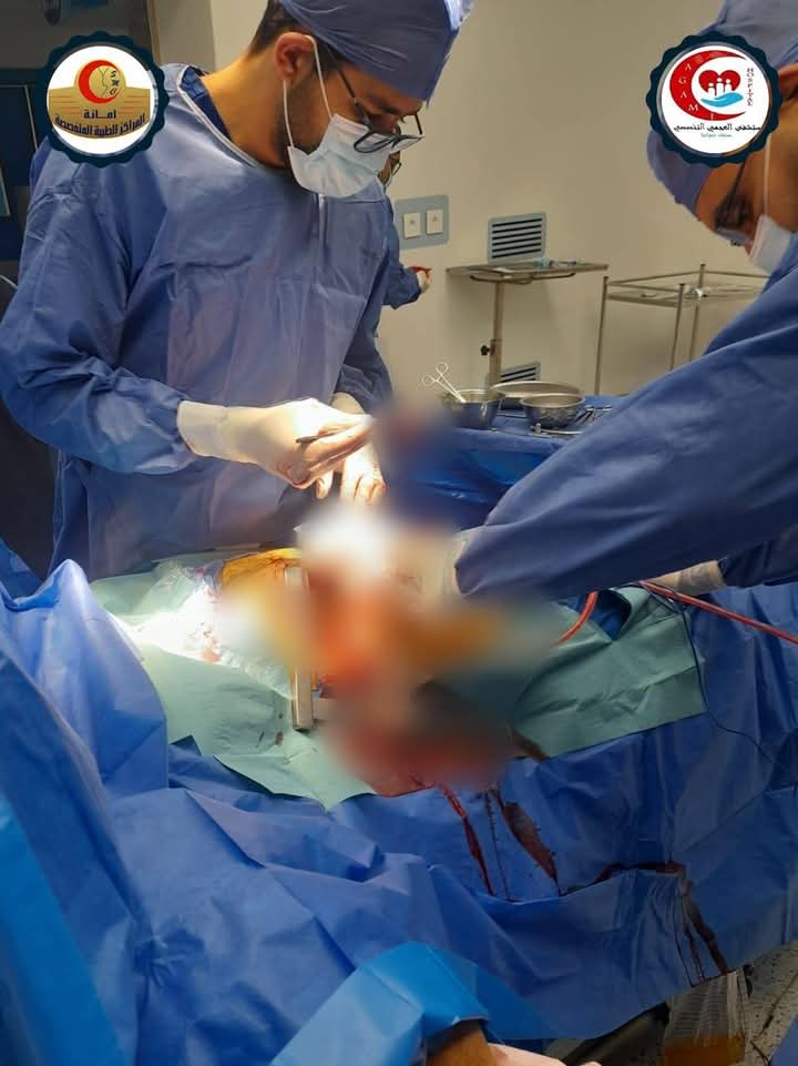الفريق الطبي خلال الجراحة