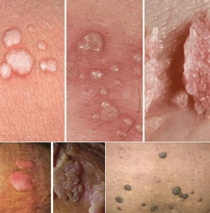 علامة تكشف تعرض الطفل للتجرش الجنسي، فيتو