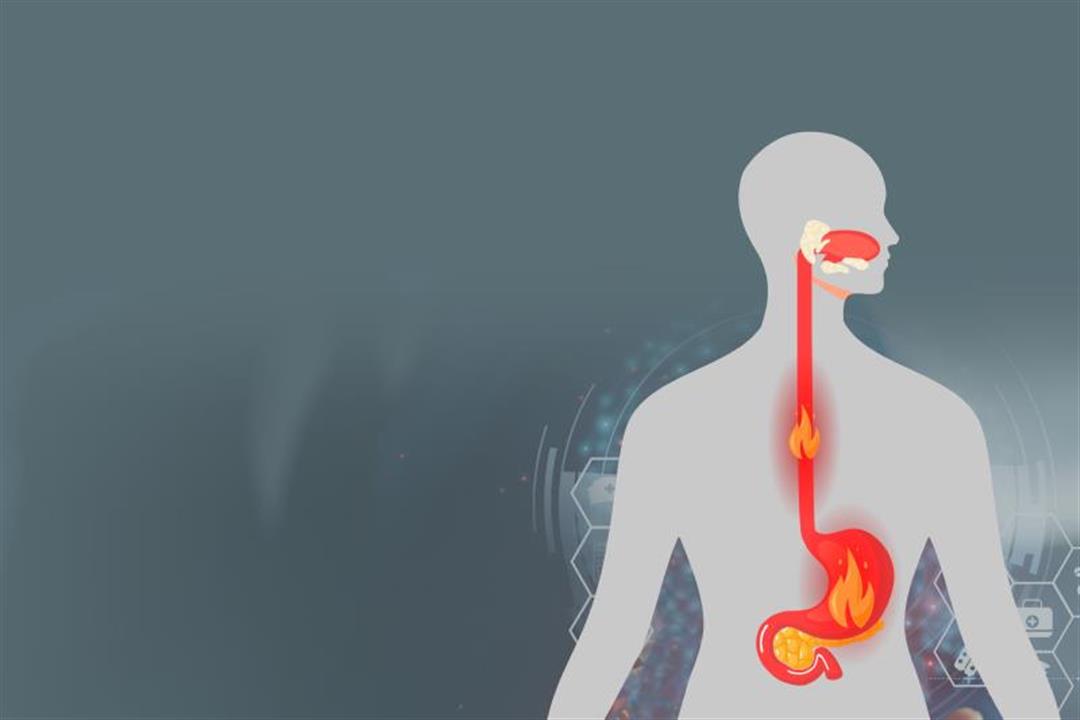 أعراض ارتجاع المريء 