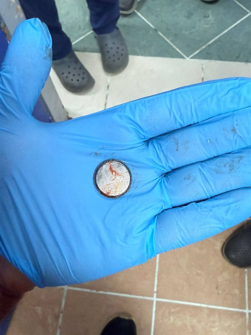 بطارية داخل مرئ طفل، فيتو