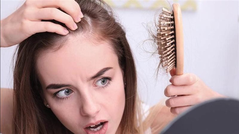 تساقط الشعر 