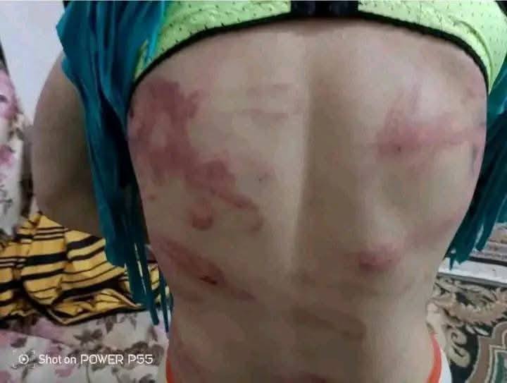 اثار الاعتداء على  