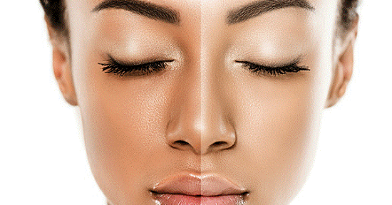 قناع طبيعي سريع المفعول لتفتيح البشرة