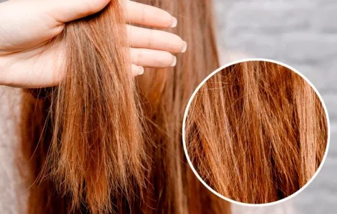 وصفة طبيعية لعلاج تكسر الشعر