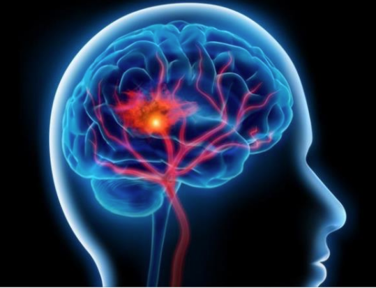 علاقة الثقب الأبيض بالجلظة المخية، فيتو