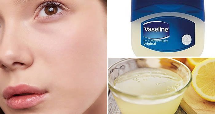 الفازلين بالليمون للبشرة