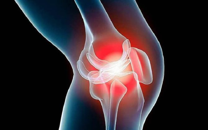 أعراض التهاب المفاصل