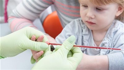 أسباب الأنيميا عند الأطفال