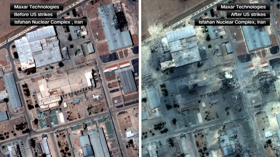 موقع إصابة الرئيس الإيراني مسعود بزكشيان، فيتو