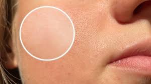 وصفات لآثار الحبوب