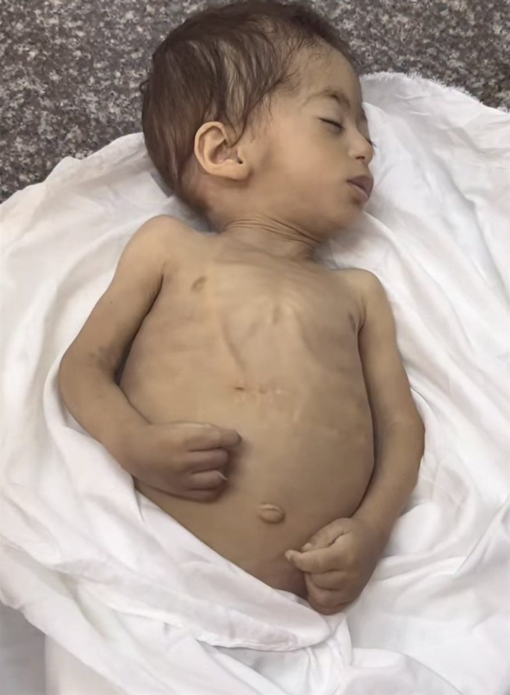 الطفلة مكة الغرابلي، فيتو