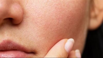 قناع طبيعي لتقشير البشرة الجافة وتنعيمها