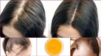 وصفة طبيعية لعلاج الشعر الخفيف وزيادة جماله 