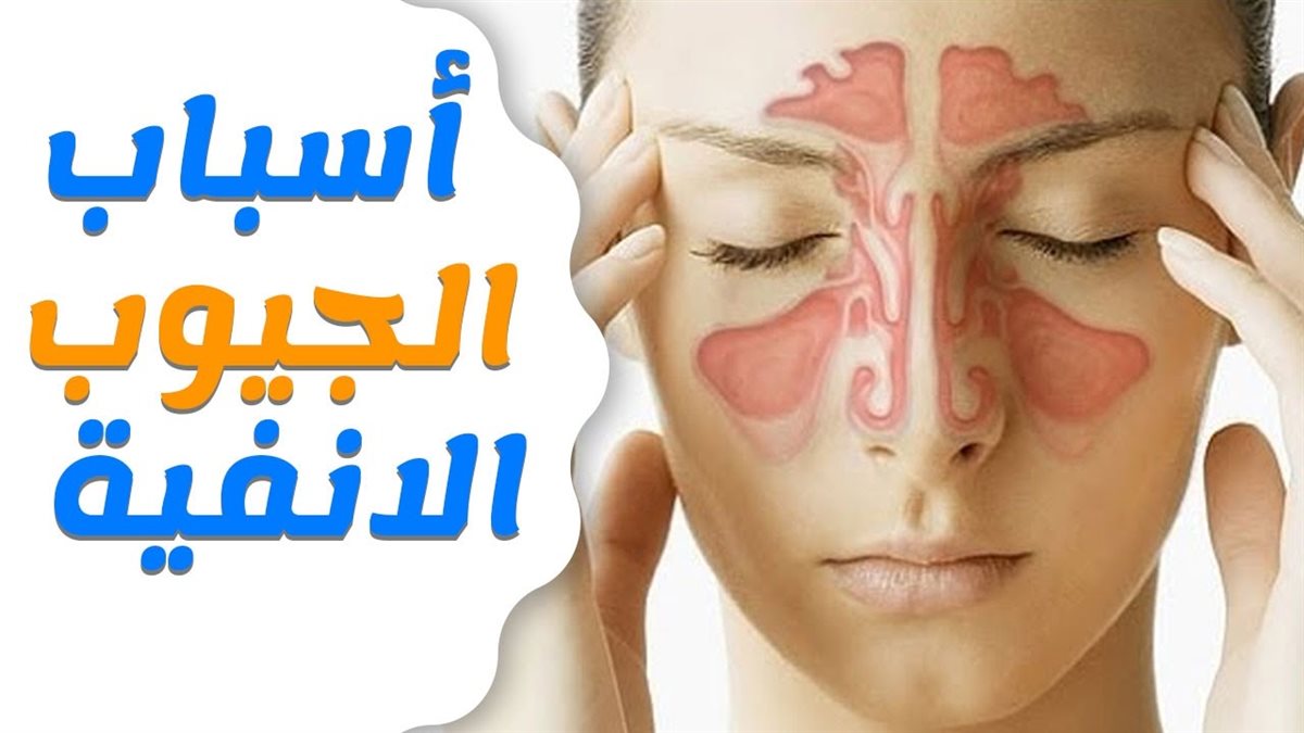 أسباب الجيوب الأنفية