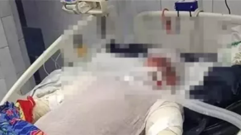 وفاة بطل حريق باكيات مترو شبرا الخيمة، فيتو