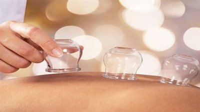 فوائد الحجامة