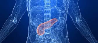 سرطان البنكرياس