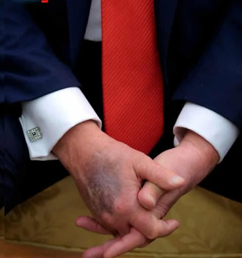 ترامب، فيتو