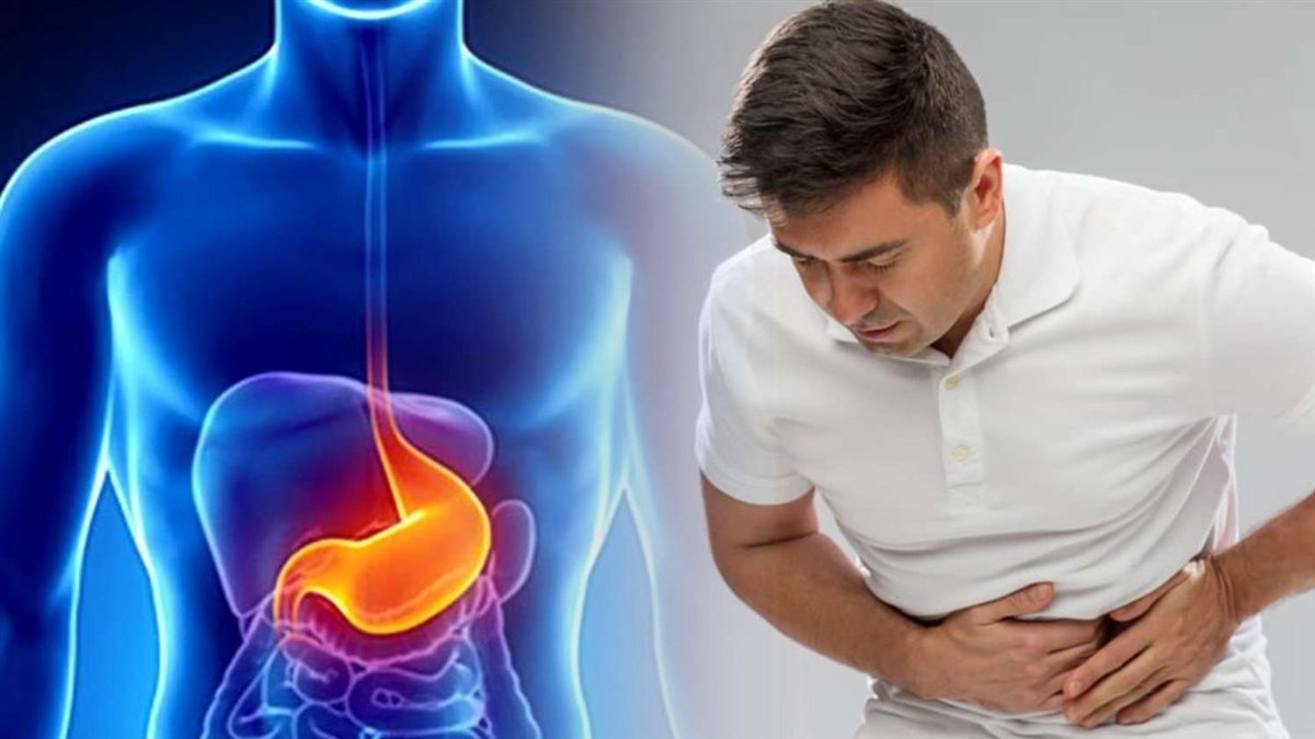 قرحة المعدة