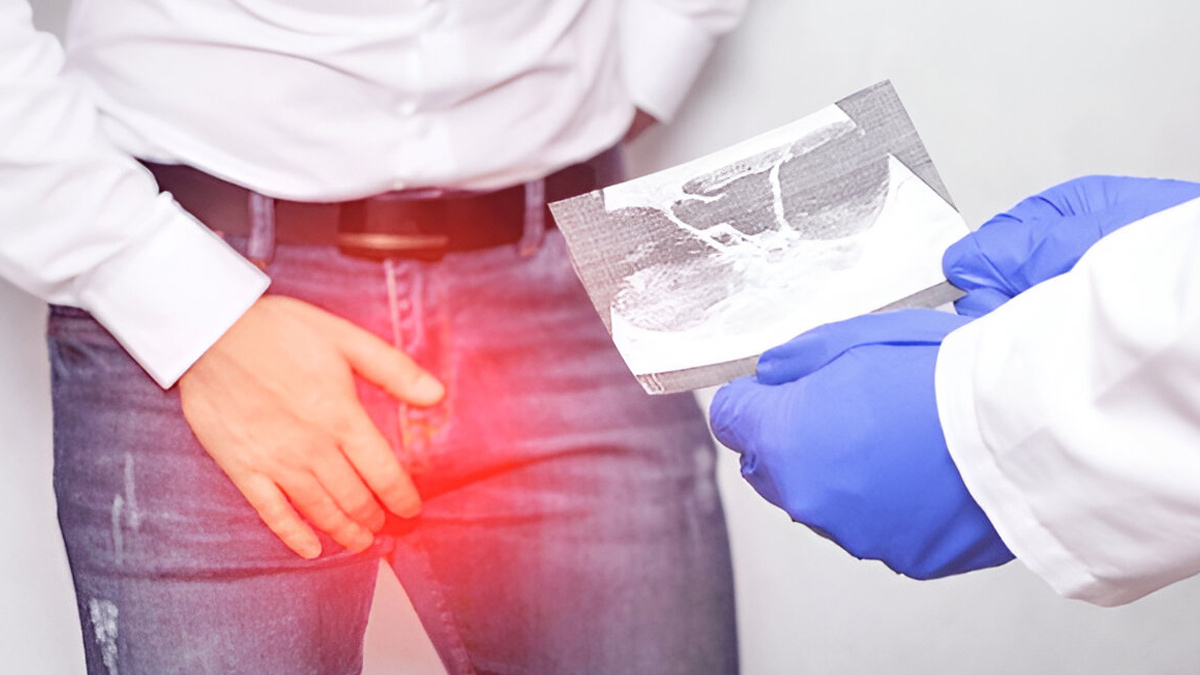 قصور الغدد التناسلية 