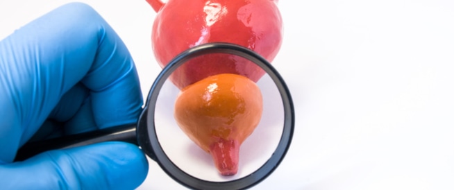 التهاب البروستاتا وأعراضها