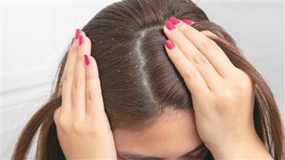 نظافة الشعر الدهني 