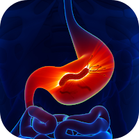 جرثومة المعدة