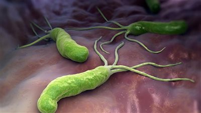 علاج جرثومة المعدة&nbsp;