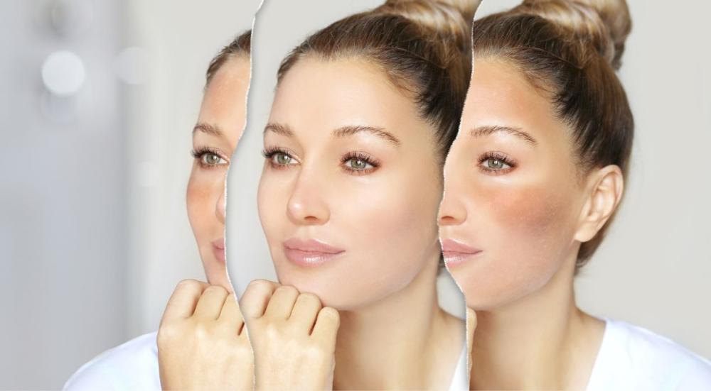 كريمات تفتيح البشرة 